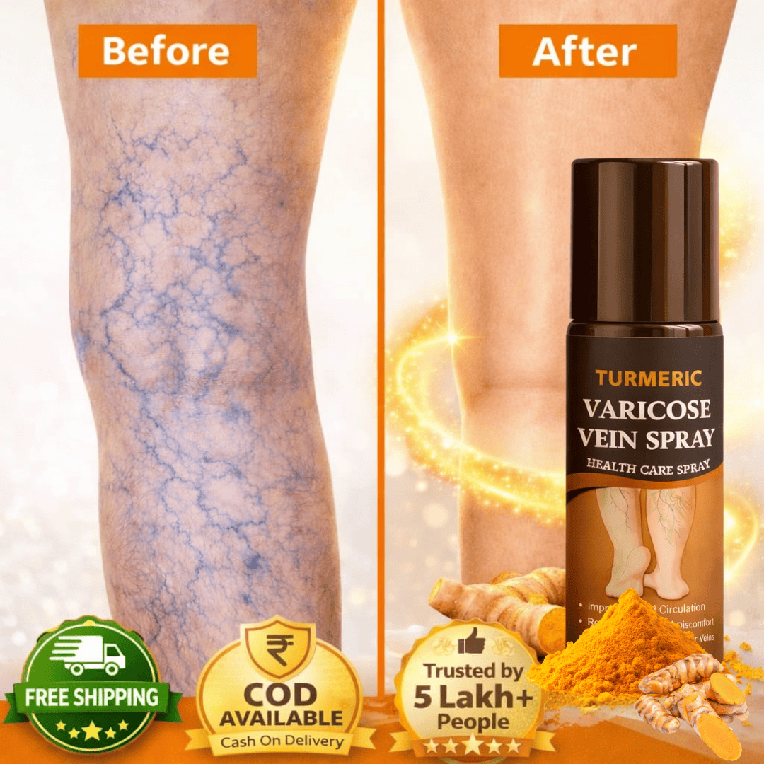 (Buy 1 Get 1 Free) Herbal Turmeric Varicose Vein Spray – Feel Relief in Minutes 🌿🟡